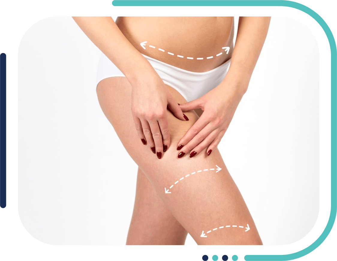 cellulite treatment in jalandhar