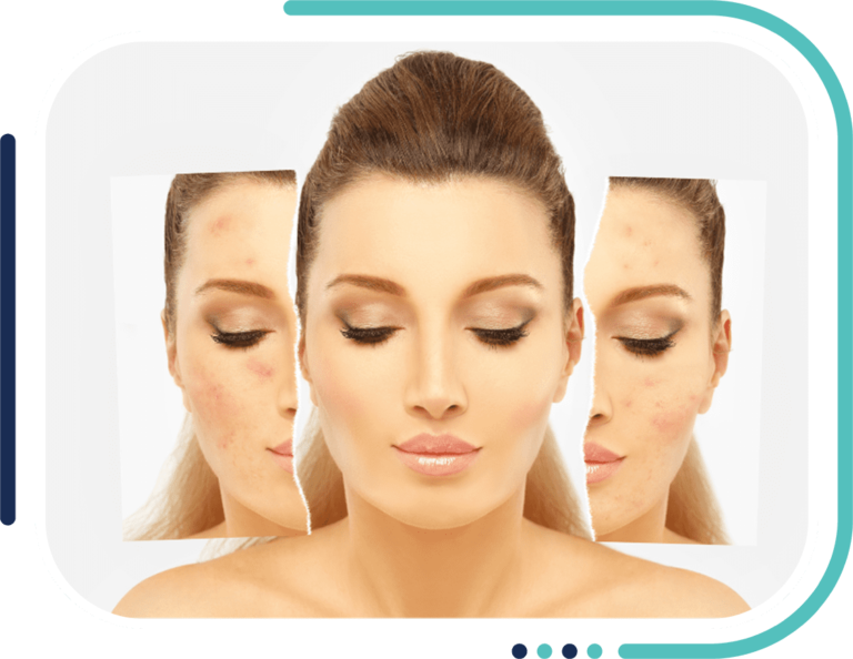 Skin Pigmentation Treatment in Jalandhar
