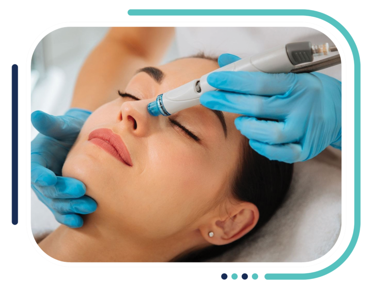 Open Pores Treatment