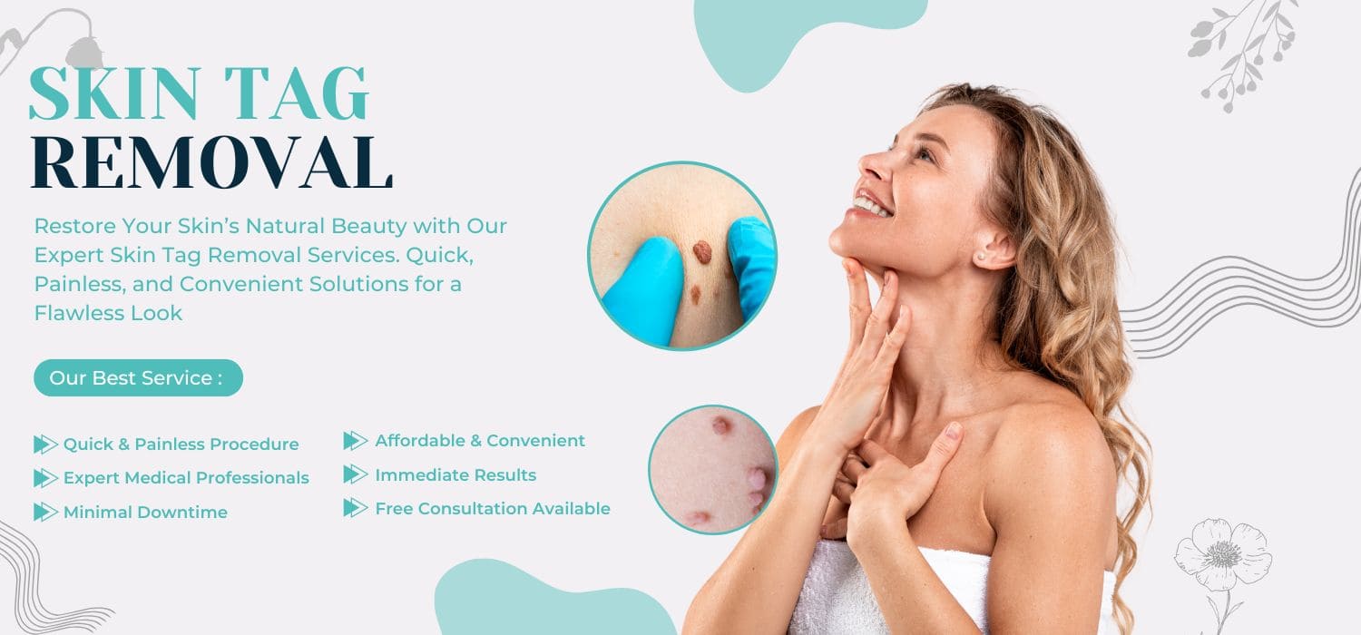 Best Skin Tag Removal Clinic Jalandhar