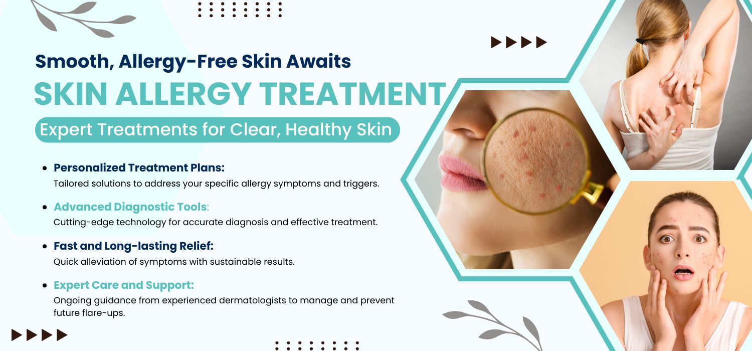 Skin Allergy Treatment in Jalandhar