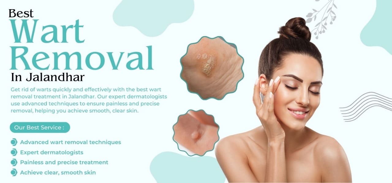 Best Wart Removal Treatment in Jalandhar
