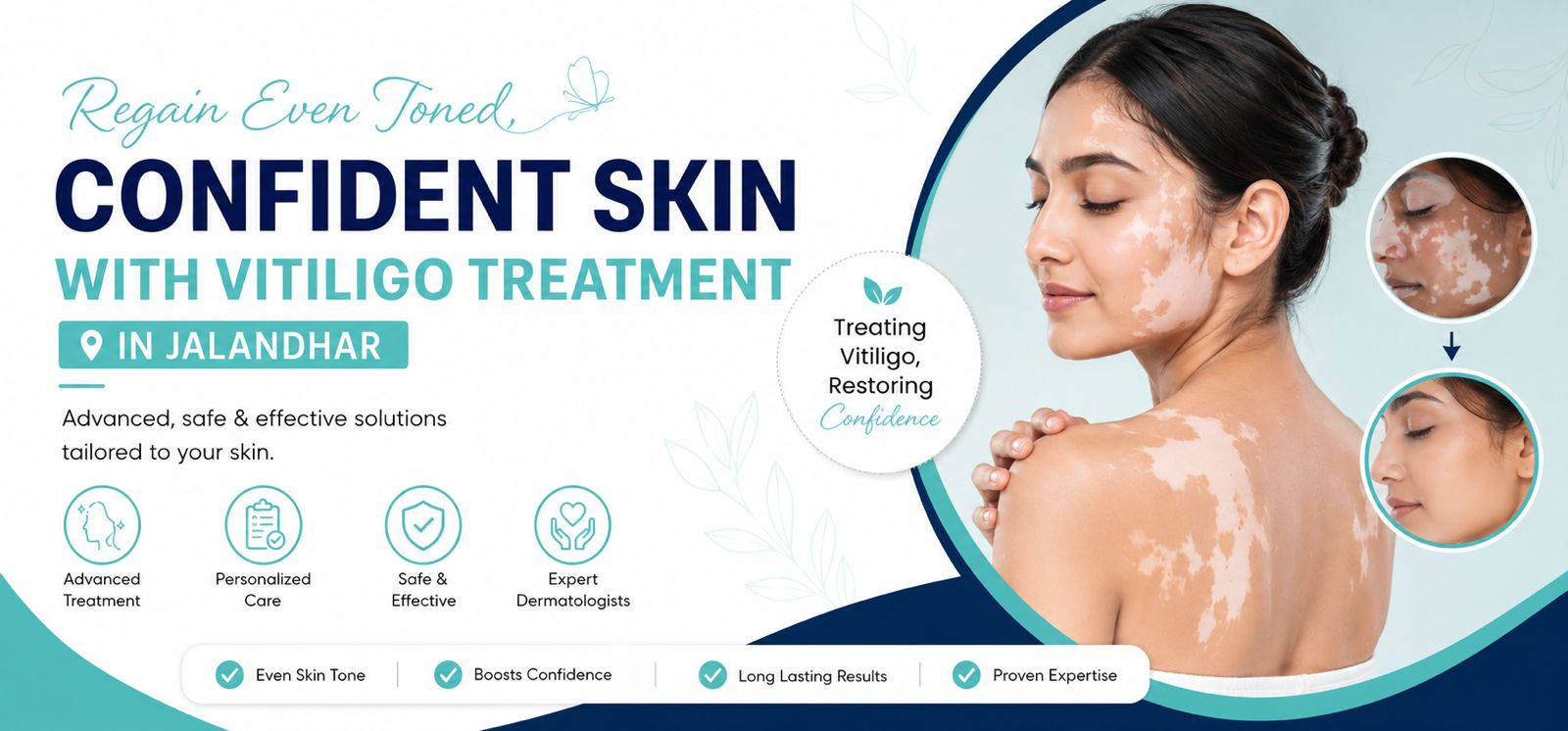Vitiligo Treatment in Jalandhar