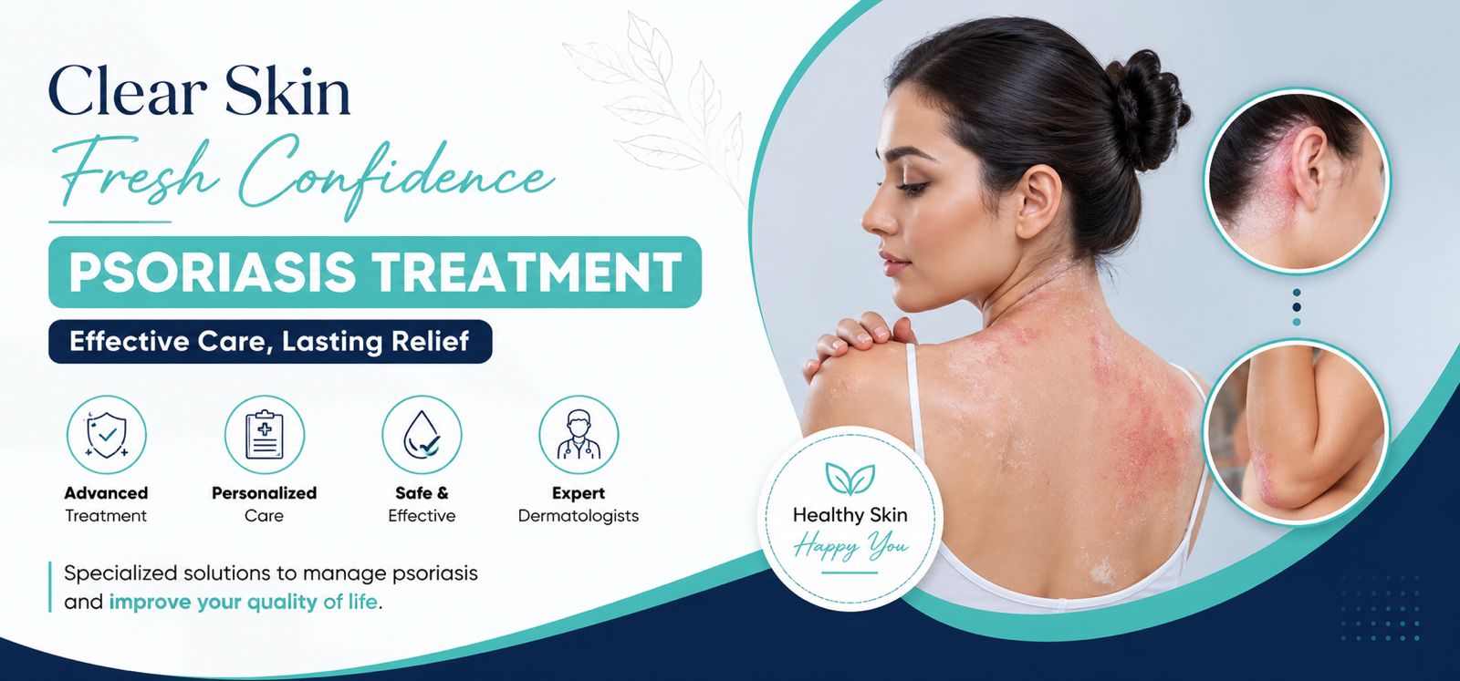 Psoriasis Treatment in Jalandhar