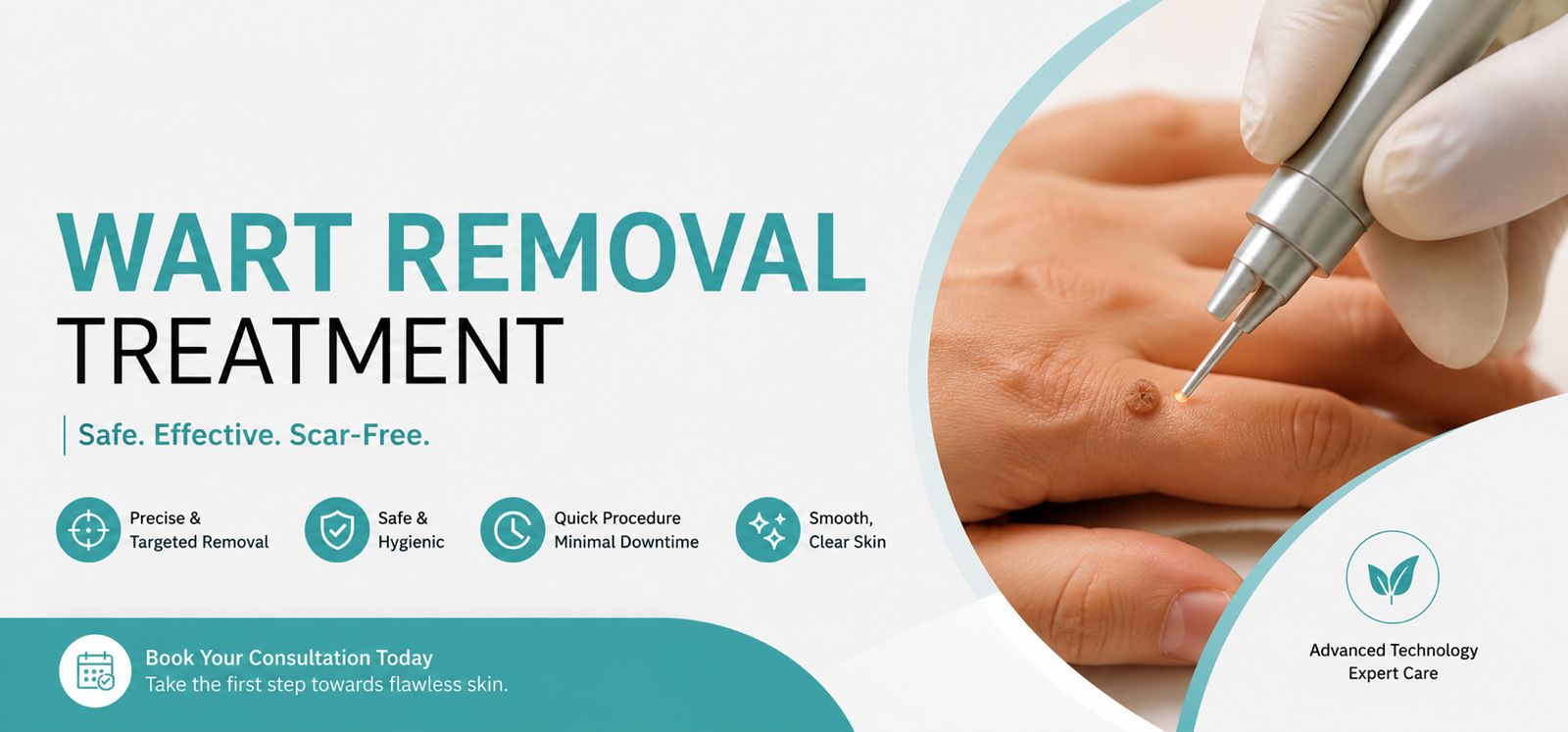 Best Wart Removal Treatment in Kapurthala
